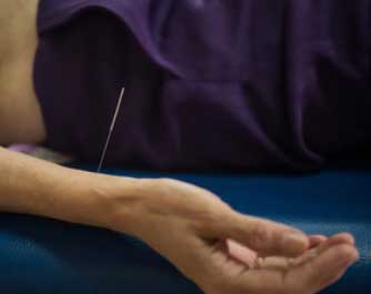 Prise de rendez-vous Acupuncteur Shangai Acupuncture Lynn Wei