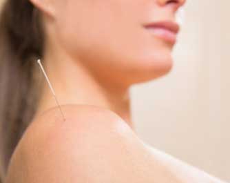 Prise de rendez-vous Acupuncteur ACKINOS