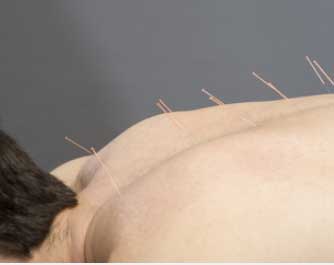 Acupuncteur ACKINOS 