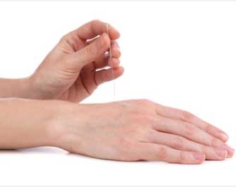 Acupuncteur Acuherb 