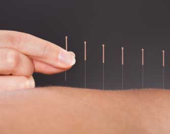 Acupuncteur Acupunctuur Griet Callens 