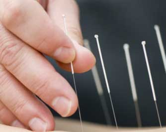 Prise de rendez-vous Acupuncteur Hugues Limet