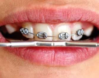 rendez-vous avec le docteur Van Bockxelaere Dominique Orthodontist